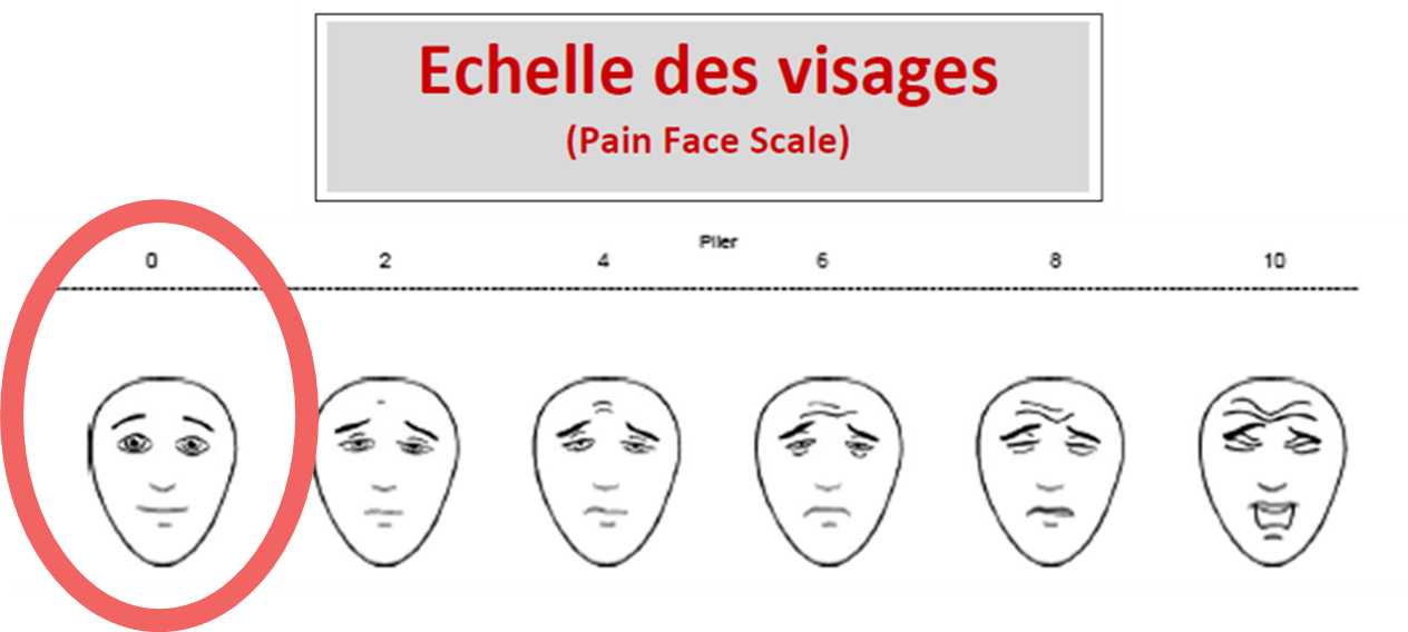 echelle des visages 